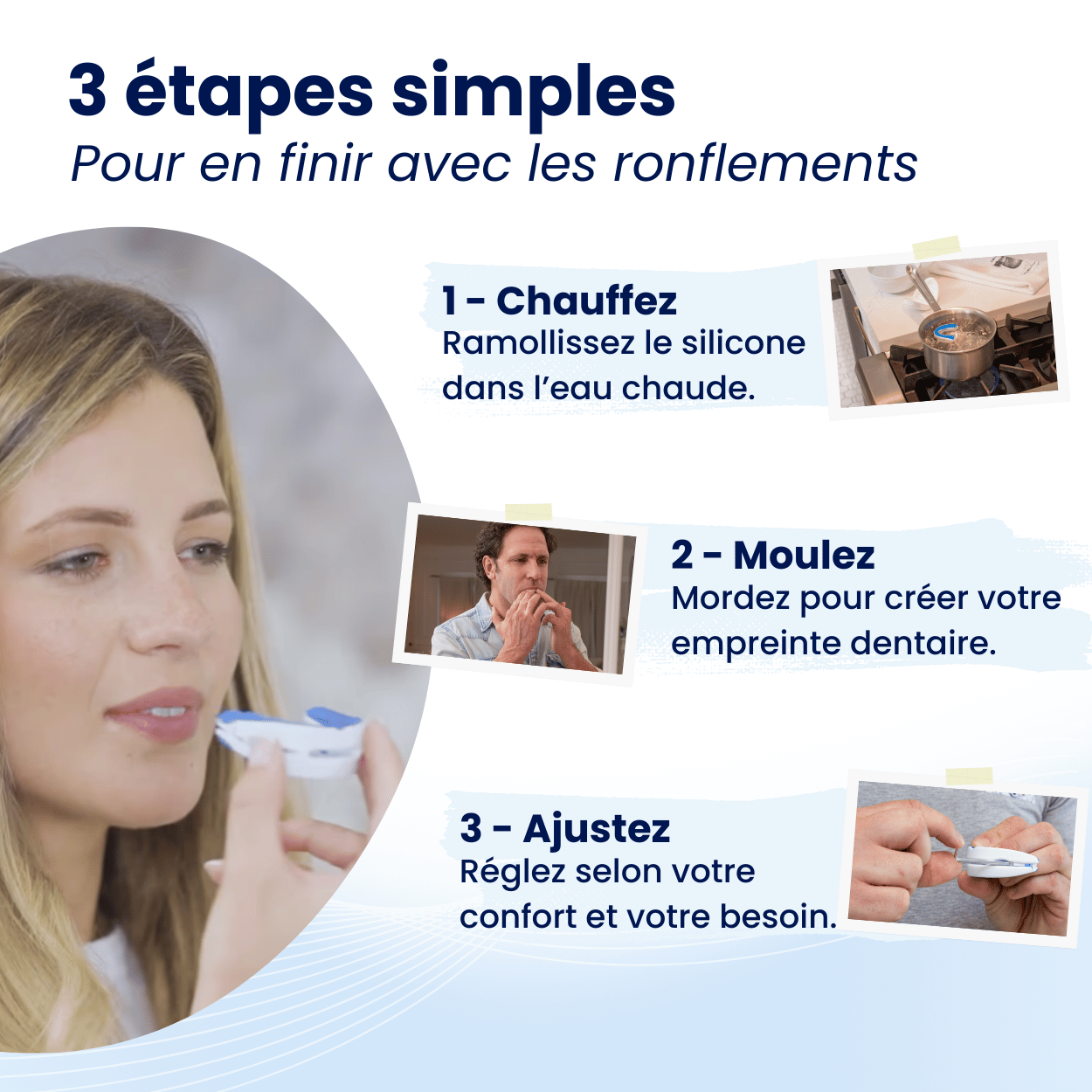 Orthèse d’avancée mandibulaire anti-ronflement